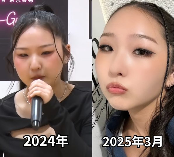 HANA CHIKA